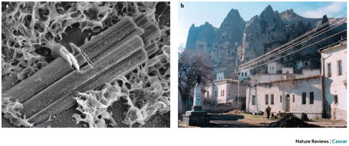 A Mesothelioma Epidemic In Cappadocia Scientific Developments And Unexpected Social Outcomes Nature Reviews Cancer