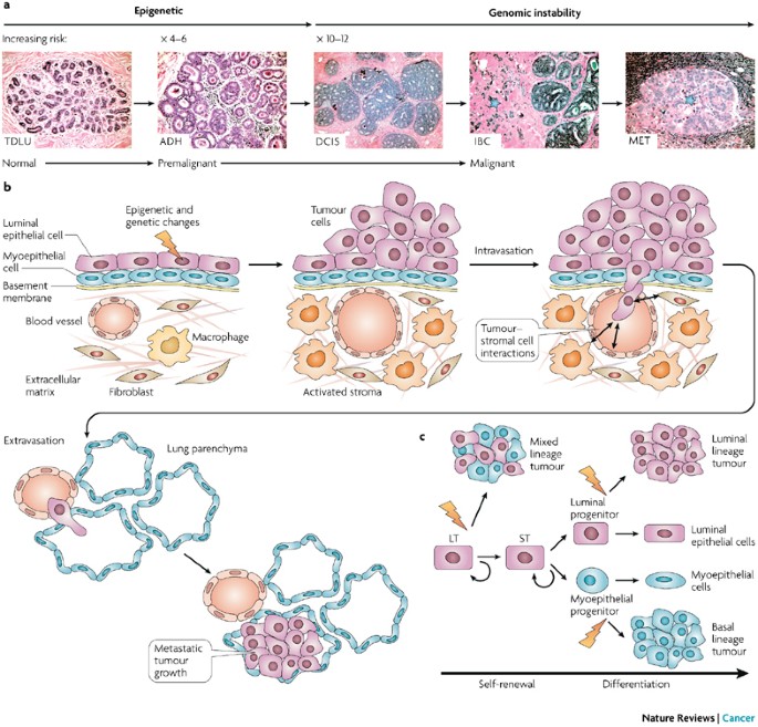 Modelling breast cancer: one size does not fit all | Nature Reviews Cancer
