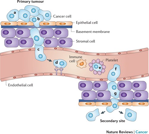 metastatic cancer and cure)