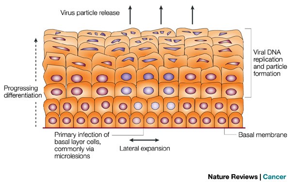emedicin humán papillomavírus