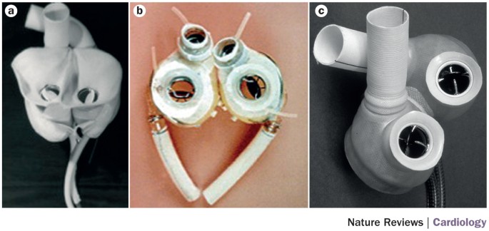 Total Artificial Heart: Procedure and Outlook