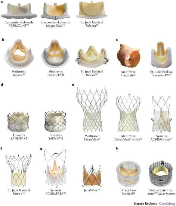 Durability of prostheses for transcatheter aortic valve implantation |  Nature Reviews Cardiology