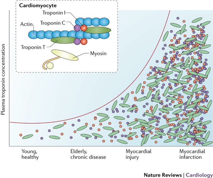 High-sensitivity assays for troponin in patients with cardiac disease |  Nature Reviews Cardiology