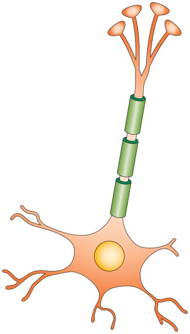 Nerves linked to prostate cancer