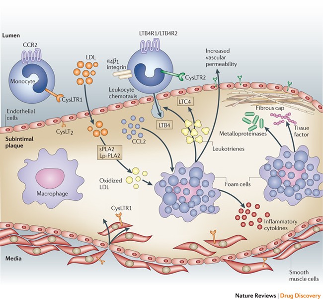 Anti-inflammatory therapeutics for the treatment of atherosclerosis - Natur...