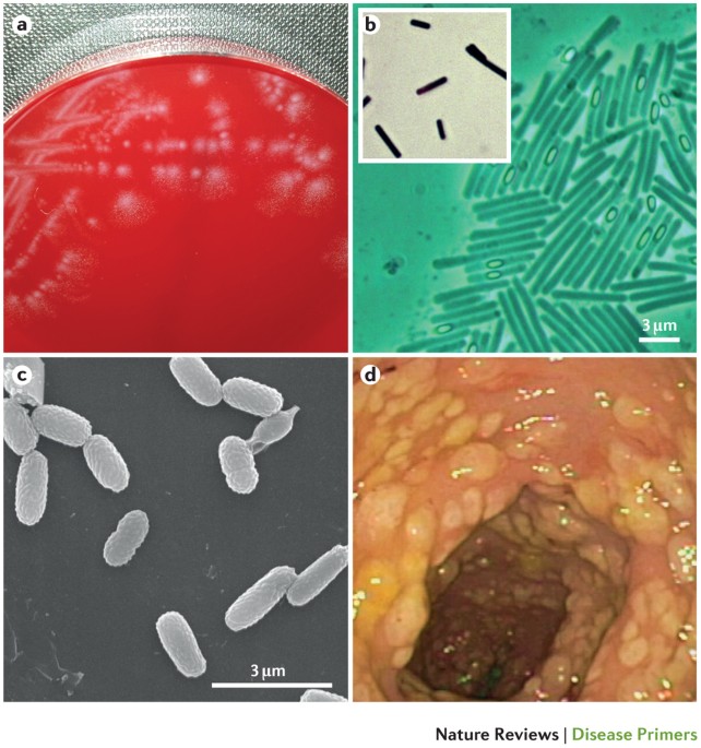 Clostridium difficile infection | Nature Reviews Disease Primers