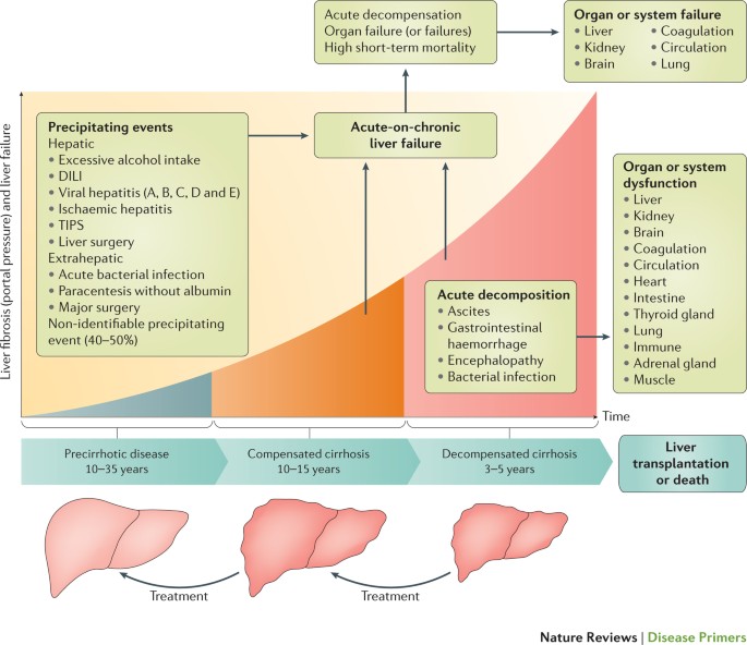 Acute-on-chronic liver failure in cirrhosis | Nature Reviews Disease Primers