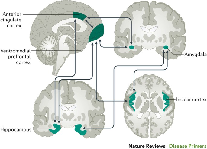 Anxiety disorders | Nature Reviews Disease Primers