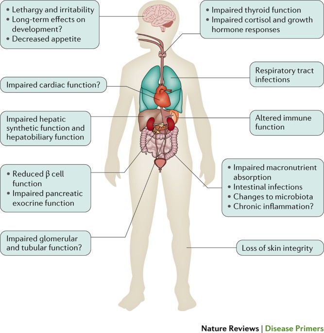 Under Nutrition Health And Social Care