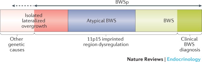 Beckwith-Wiedemann Syndrome - GeneReviews® - NCBI Bookshelf