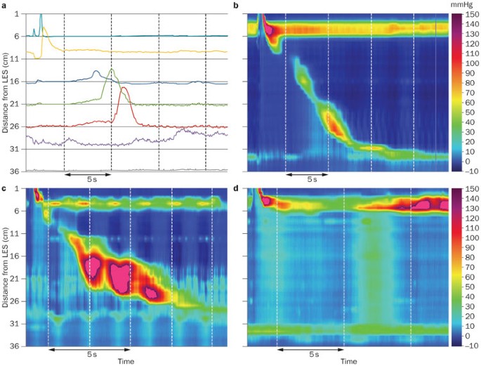 Advances in motility testing—current and novel approaches