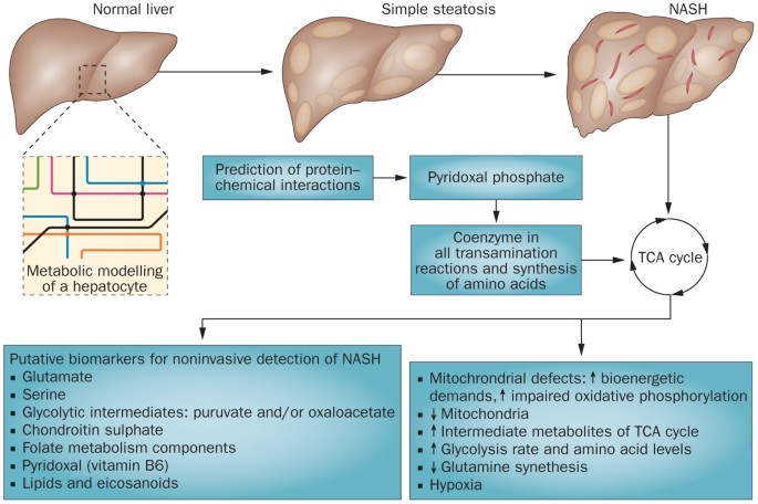 Metabolic make-up of nash: from fat and sugar to amino acids