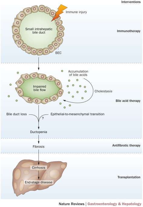 Novel Therapeutic Targets In Primary Biliary Cirrhosis Nature
