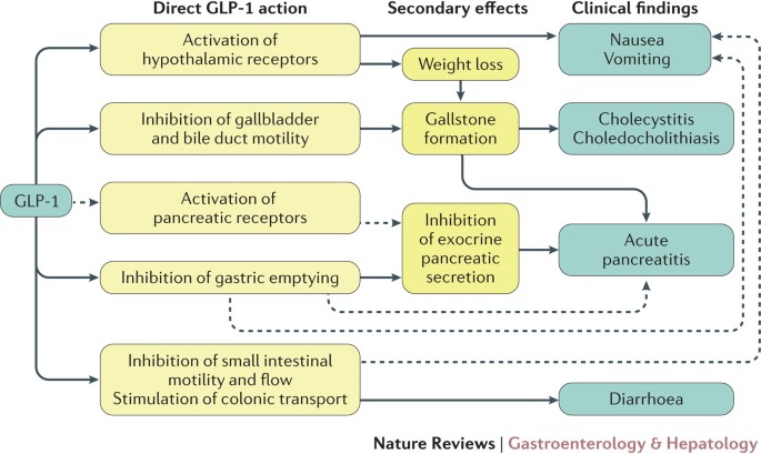 glp-1 and gallstones Gastrointestinal safety of incretin therapies: are we there yet?