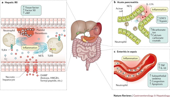 Frontiers  The implication of neutrophil extracellular traps in  nonalcoholic fatty liver disease