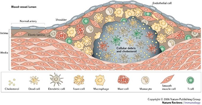 The immune response in atherosclerosis: double-edged | Reviews Immunology