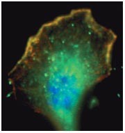 Jmy: actin up in cell motility