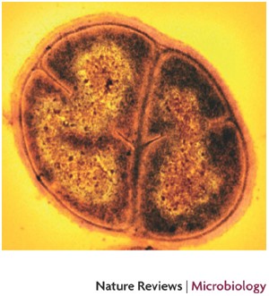 Deinococcus radiodurans