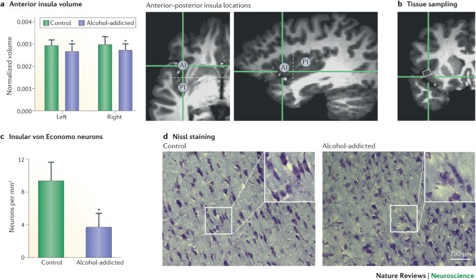 Time to connect: bringing social context into addiction neuroscience