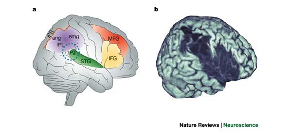 Non Spatially Lateralized Mechanisms In Hemispatial Neglect Nature Reviews Neuroscience
