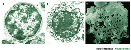 The biochemistry of neuronal necrosis: rogue biology?