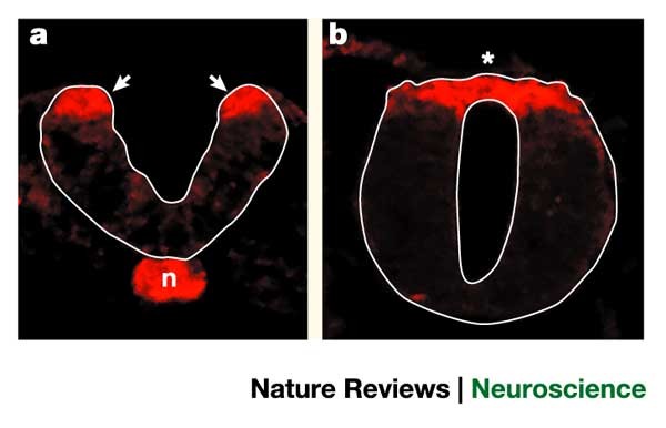 Mechanisms Of Roof Plate Formation In The Vertebrate Cns Nature