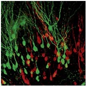 Does age matter? | Nature Reviews Neuroscience