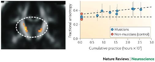 Music in the brain  Nature Reviews Neuroscience