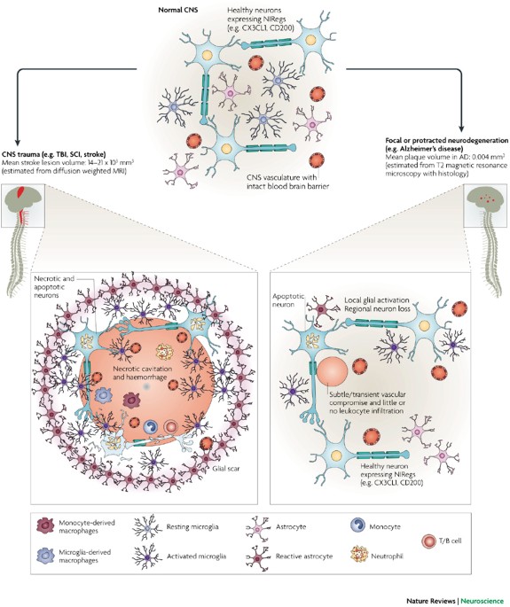 Can the immune system be harnessed to repair the CNS? | Nature Reviews Neuroscience can-the-immune-system-be-harnessed-to-repair-the-cns-nature-reviews-neuroscience