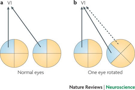 Shadows Cast by Retinal Blood Vessels Mapped in Primary Visual Cortex