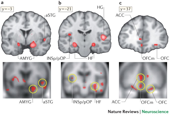 Music in the brain  Nature Reviews Neuroscience