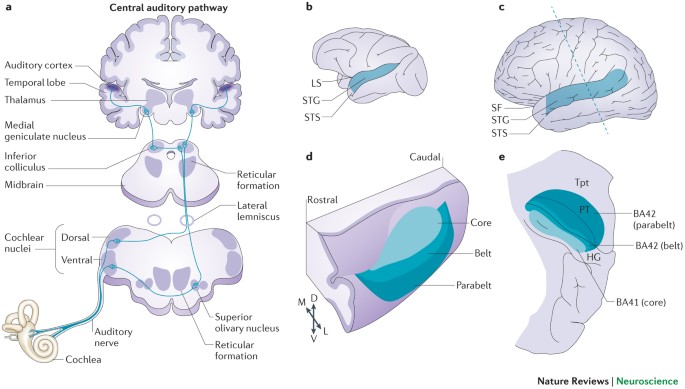 Auditory dysfunction in schizophrenia: integrating clinical and basic features - Nature Reviews Neuroscience