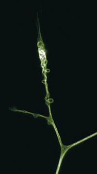 Recoil and retract | Nature Reviews Neuroscience