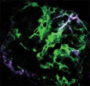 Albuminuria inhibits podocyte regeneration