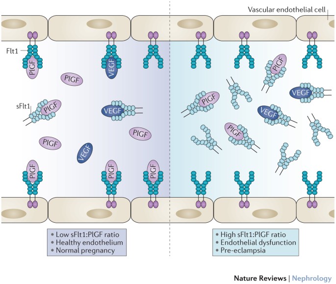 Testing for pre-eclampsia: paving the way to early diagnosis