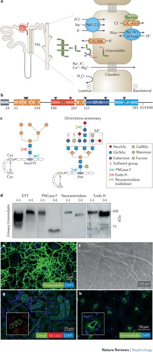 Uromodulin: from physiology to rare and complex kidney disorders | Nature  Reviews Nephrology