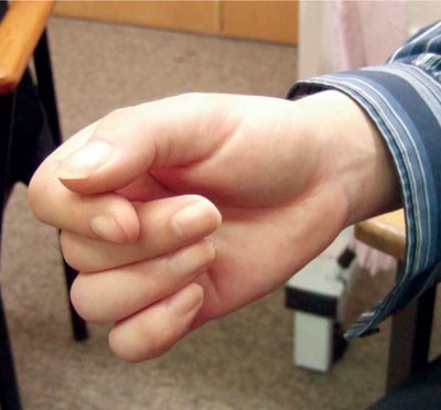 Мужчины с большими животами. Подростка трясет. Тремор рук. Тремор рук причины у подростка. Тремор рук.