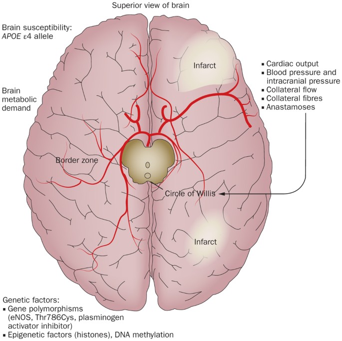 Subarachnoid Hemorrhage (SAH) - Brain, Spinal Cord, and Nerve Disorders -  Merck Manuals Consumer Version