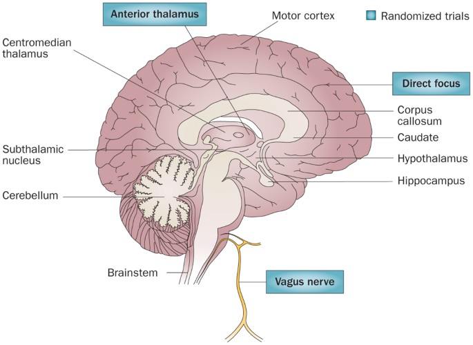 PDF) Epilepsy and the Laboratory Technician: Technique in Histology and  Fiction