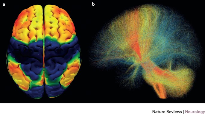 Deep brain stimulation — making the right connections