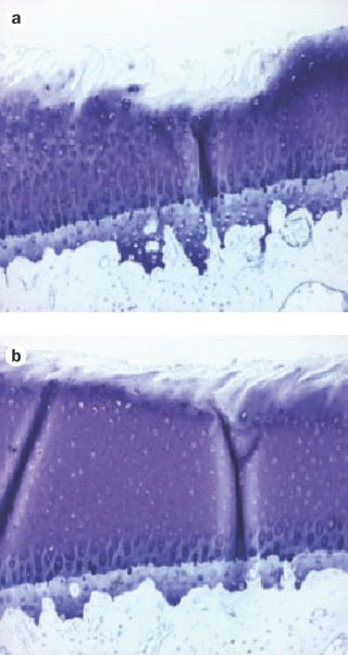 Targeting cathepsin k to prevent cartilage loss: evidence from a dog model of oa