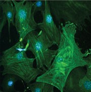 Elucidating the origins of lung fibrosis