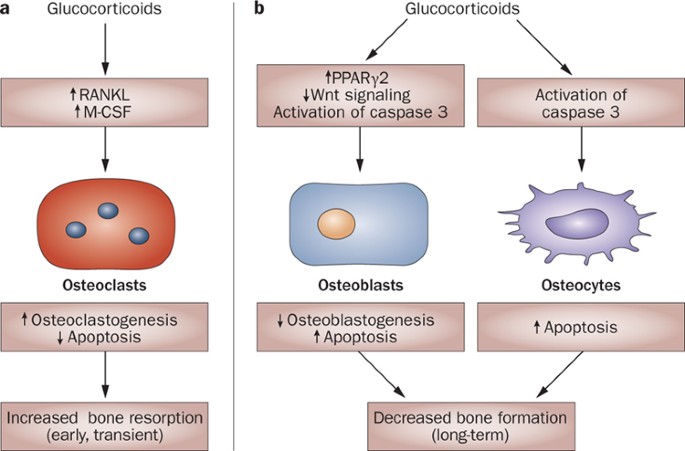 Management of glucocorticoid-induced osteoporosis | Nature Reviews ...