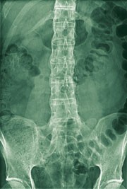 New insights into therapy—tnf blockade and beyond