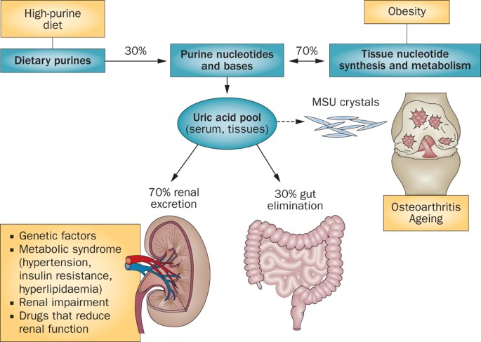 Optimizing current treatment of gout | Nature Reviews Rheumatology