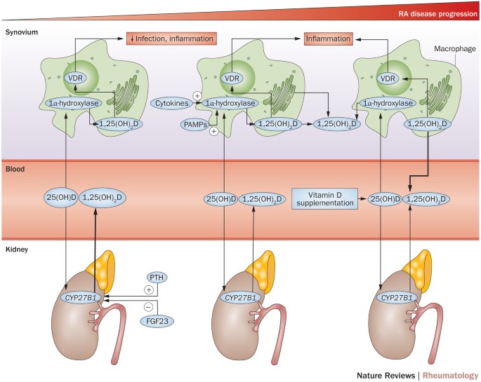 Vitamin D In Rheumatoid Arthritis—Towards Clinical Application | Nature  Reviews Rheumatology
