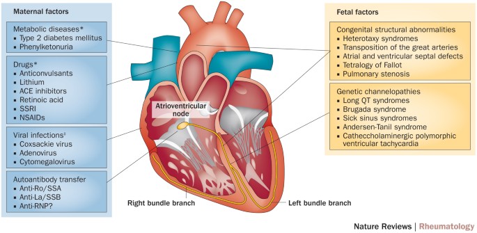 Heart chamber anatomy PI - UpToDate