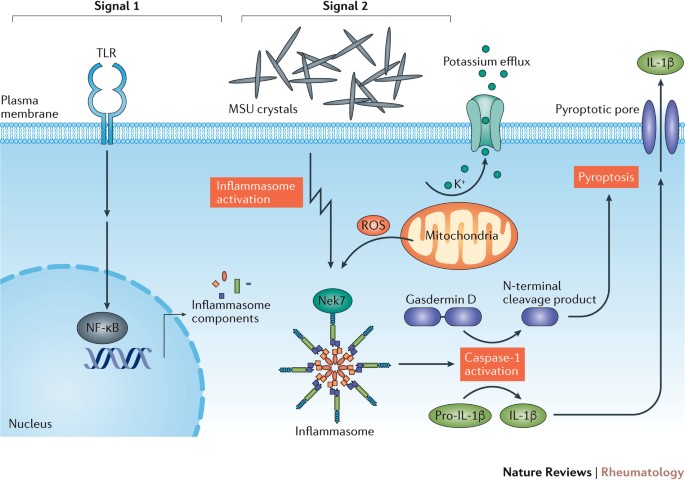 Inflammation in gout: mechanisms and therapeutic targets