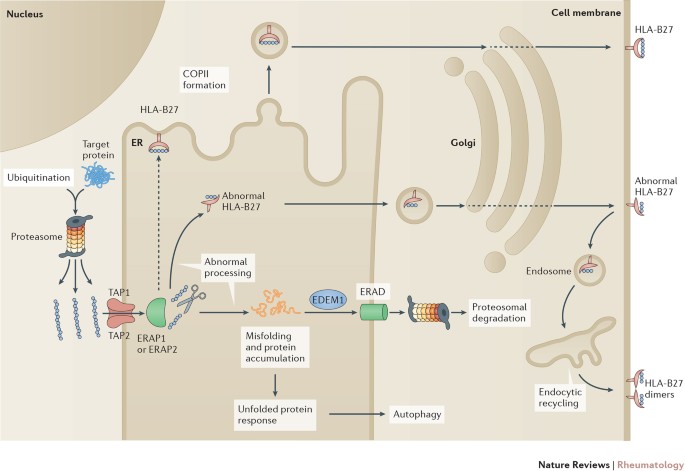 Pathogenesis Of Ankylosing Spondylitis Recent Advances And Future Directions Nature Reviews Rheumatology