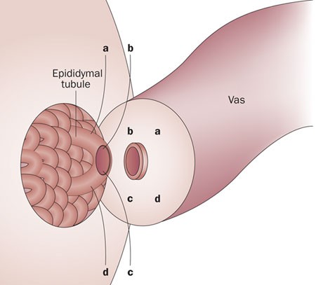 Current status of vasectomy reversal